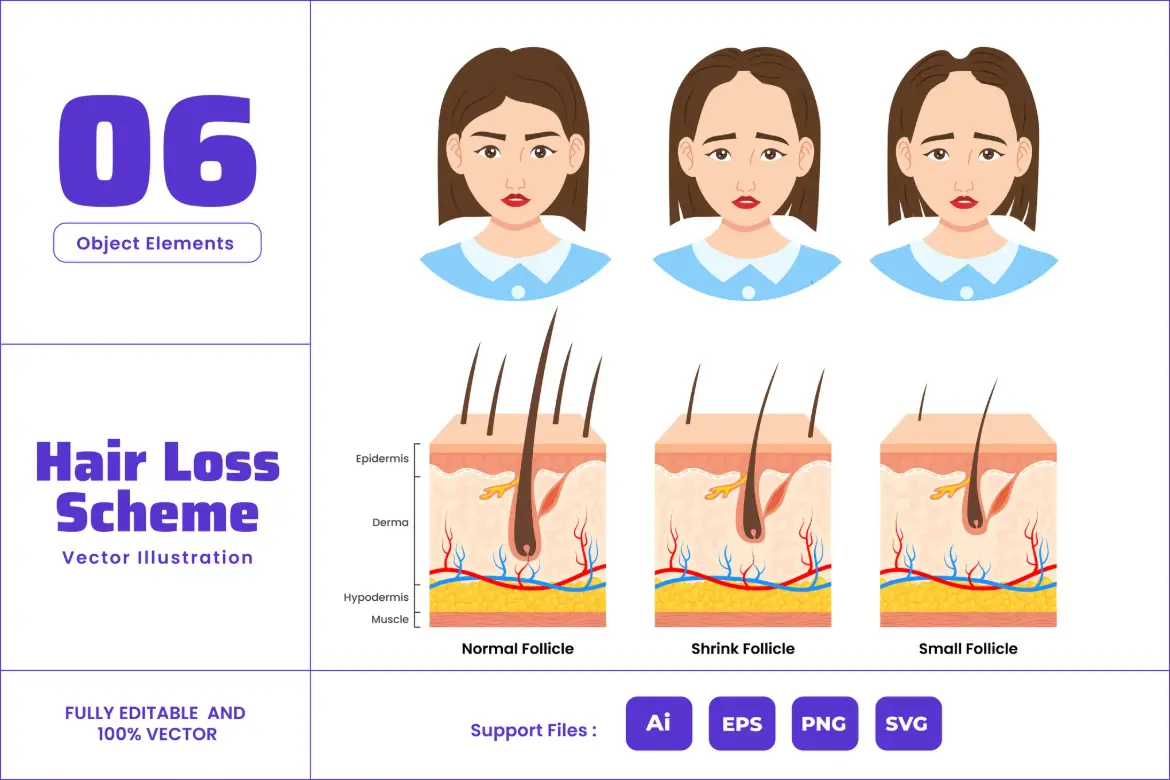 脱发与毛发生长医学图表矢量图AI/EPS/SVG/PNG毛囊健康科普设计素材